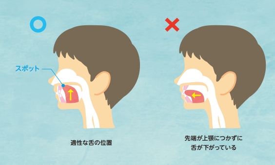 舌の位置にも注意が必要