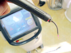 歯をも削れるレーザー機器