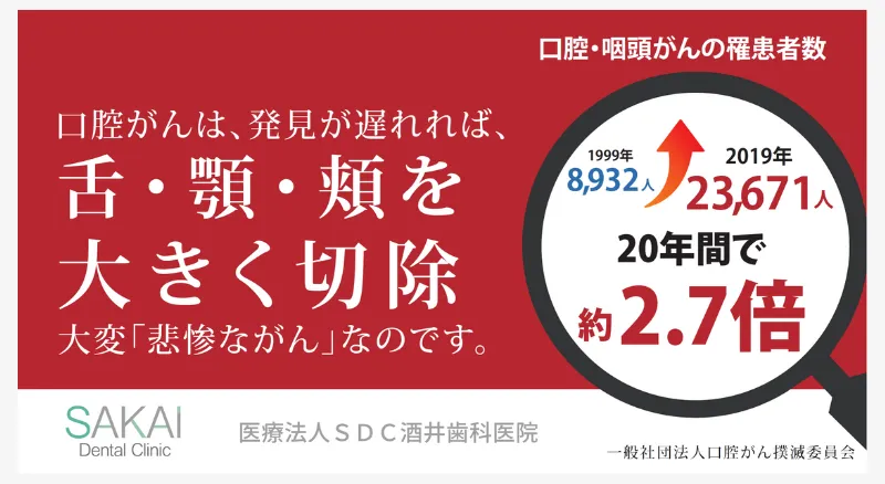 舌癌や口腔がん | いわき市の歯医者 酒井歯科医院